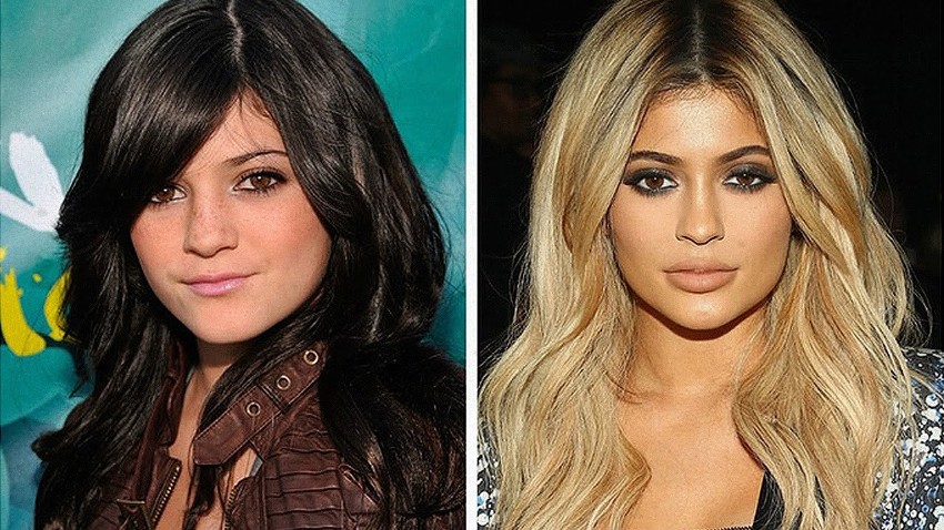 Celebrity Plastic surgeries